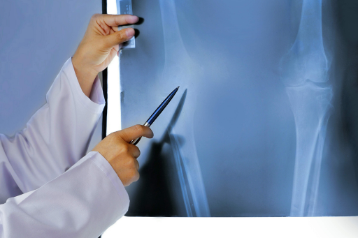 best orthopedic doctor in greater Noida