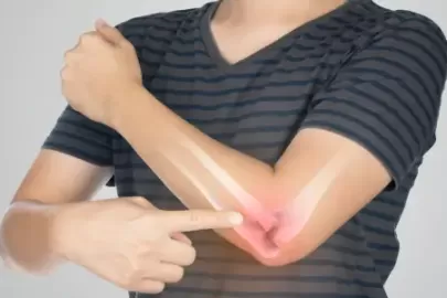 Understanding the Importance of Healthy Bones