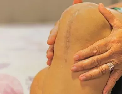 Back on Your Feet Faster: Modern Knee Surgery Recovery Facts