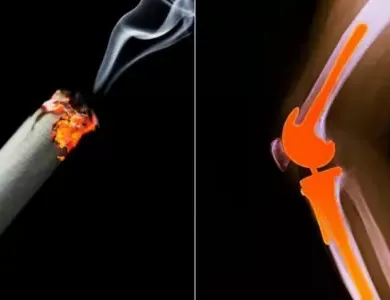 How Smoking Damages Your Bones and Joints: Expert Insights