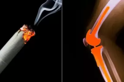 How Smoking Damages Your Bones and Joints: Expert Insights