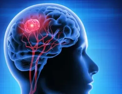 Early Detection: Why Timely Treatment of Brain Tumors is Crucial