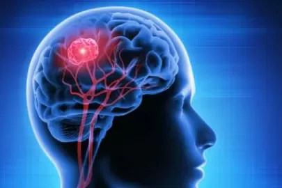 Early Detection: Why Timely Treatment of Brain Tumors is Crucial