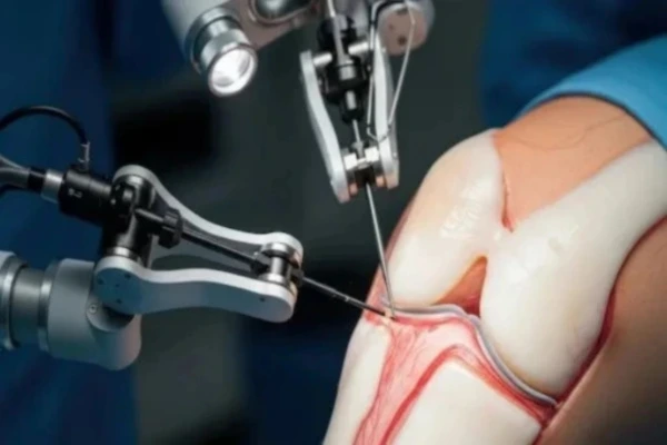 robotic-knee-landing