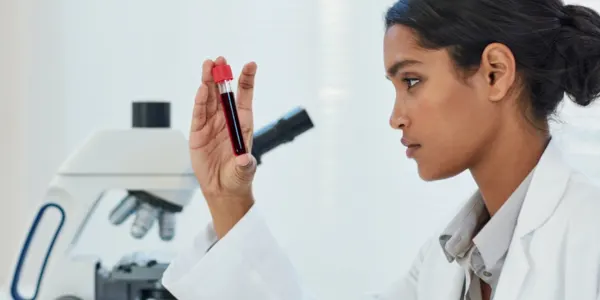 How to Increase Platelet Count
