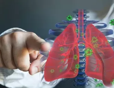 Is Lung Cancer Contagious