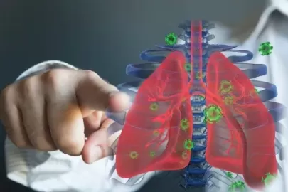 Is Lung Cancer Contagious