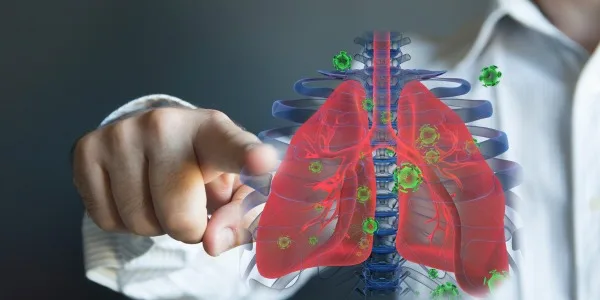 Is Lung Cancer Contagious