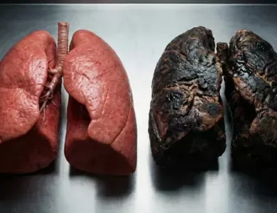 Processed Food Lung Cancer
