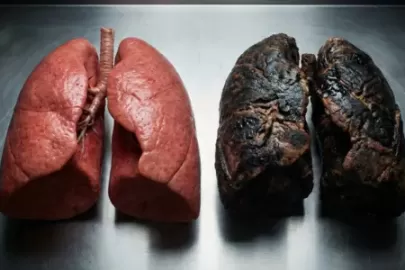 Processed Food Lung Cancer