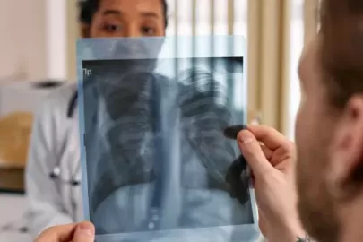 Lung Cancer Ke Lakshan
