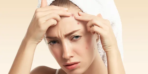 forehead pimples reason​